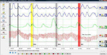 Polygraph Score Chart